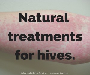 Suffer from hives-